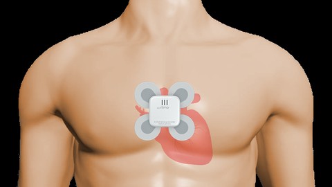 HanseMerkur bietet smarte Schlaganfallvorsorge mittels Mini-EKG 