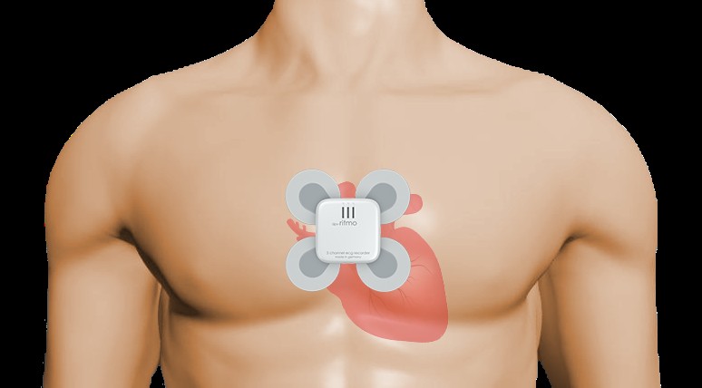 HanseMerkur bietet smarte Schlaganfallvorsorge mittels Mini-EKG 